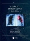 Clinical Tuberculosis - Book