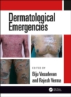 Dermatological Emergencies - Book