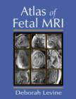 Atlas of Fetal MRI - Book