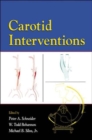 Carotid Interventions - Book