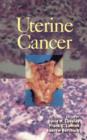 Uterine Cancer - Book