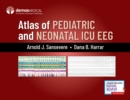 Atlas of Pediatric and Neonatal ICU EEG - Book