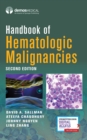 Handbook of Hematologic Malignancies - Book