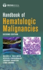 Handbook of Hematologic Malignancies - eBook