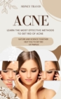 Acne : Learn the Most Effective Methods to Get Rid of Acne (Nature and Science Together Help You to Get Rid of Pimples) - eBook