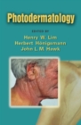 Photodermatology - eBook