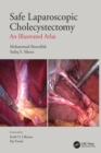 Safe Laparoscopic Cholecystectomy : An Illustrated Atlas - Book