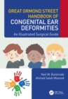 Great Ormond Street Handbook of Congenital Ear ?Deformities : An Illustrated Surgical Guide - Book