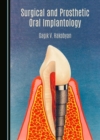 Surgical and Prosthetic Oral Implantology - eBook