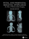 Fetal and Perinatal Skeletal Dysplasias : An Atlas of Multimodality Imaging - eBook