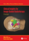 Clinical Insights for Image-Guided Radiotherapy : Prostate - eBook