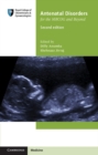 Antenatal Disorders for the MRCOG and Beyond - Book