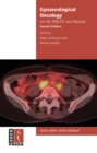 Gynaecological Oncology for the MRCOG and Beyond - eBook