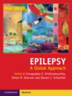 Epilepsy : A Global Approach - eBook