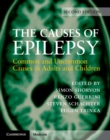 Causes of Epilepsy : Common and Uncommon Causes in Adults and Children - eBook