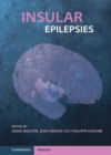 Insular Epilepsies - Book