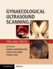 Gynaecological Ultrasound Scanning : Tips and Tricks - eBook