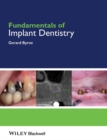 Fundamentals of Implant Dentistry - eBook