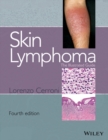 Skin Lymphoma : The Illustrated Guide - eBook