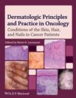 Dermatologic Principles and Practice in Oncology : Conditions of the Skin, Hair, and Nails in Cancer Patients - eBook