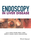 Endoscopy in Liver Disease - Book