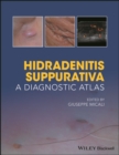 Hidradenitis Suppurativa : A Diagnostic Atlas - Book