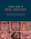 Clinical Guide to Oral Diseases - eBook