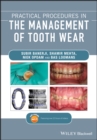 Practical Procedures in the Management of Tooth Wear - Book