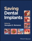 Saving Dental Implants - eBook