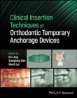 Clinical Insertion Techniques of Orthodontic Temporary Anchorage Devices - Book