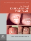 An Atlas of Diseases of the Nail - eBook
