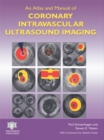 An Atlas and Manual of Coronary Intravascular Ultrasound Imaging - eBook