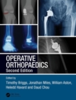 Operative Orthopaedics - Book