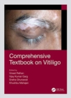 Comprehensive Textbook on Vitiligo - Book