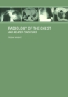 Radiology of the Chest and Related Conditions - Book