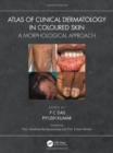 Atlas of Clinical Dermatology in Coloured Skin : A Morphological Approach - Book