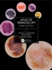 Atlas of Dermoscopy : Third Edition - Book