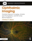 Ophthalmic Imaging : Posterior Segment Imaging, Anterior Eye Photography, and Slit Lamp Biomicrography - Book