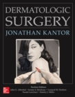 Dermatologic Surgery - Book