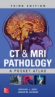 CT & MRI Pathology: A Pocket Atlas, Third Edition - eBook
