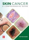 Skin Cancer: A Comprehensive Guide - Book