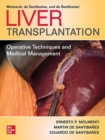 Liver Transplantation: Operative Techniques and Medical Management - Book