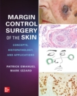 Margin Control Surgery of the Skin: Concepts, Histopathology, and Applications - eBook