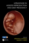 Ultrasound in Assisted Reproduction and Early Pregnancy - eBook