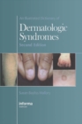 An Illustrated Dictionary of Dermatologic Syndromes - eBook