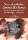 Diagnosing the Less Common Skin Tumors : Clinical Appearance and Dermoscopy Correlation - eBook