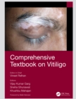 Comprehensive Textbook on Vitiligo - eBook