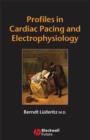 Profiles in Cardiac Pacing and Electrophysiology - Book