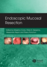 Endoscopic Mucosal Resection - Book
