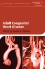 Adult Congenital Heart Disease - Book